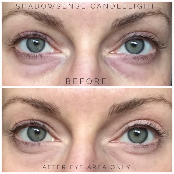 Shadowsense - Picture 12 of 12